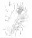 Fig. 09 - Expandable spinal implant and method of implanting same