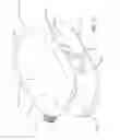 Fig. 16 - Expandable spinal implant and method of implanting same