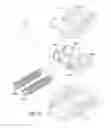 Fig. 35 - Expandable spinal implant and method of implanting same