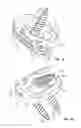 Fig. 02 - RETAINING MECHANISM, IMPLANT, AND TOOL