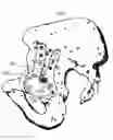 Fig. 01 - Device for attaching a positioning device to a bone of a patient, device for treating a bone of a patient, and hip implant system