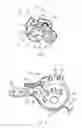 Fig. 02 - Device for attaching a positioning device to a bone of a patient, device for treating a bone of a patient, and hip implant system