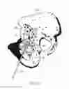 Fig. 09 - Device for attaching a positioning device to a bone of a patient, device for treating a bone of a patient, and hip implant system