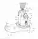 Fig. 01 - Prosthesis with a passive release device