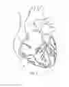 Fig. 02 - Medical device