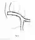 Fig. 04 - Medical device