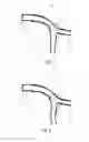 Fig. 05 - Medical device