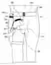 Fig. 01 - Catheter collection and drainage device and system