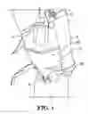 Fig. 02 - Catheter collection and drainage device and system