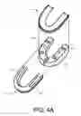 Fig. 06 - ORAL MOTION PRESERVATION DEVICE