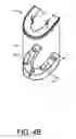 Fig. 07 - ORAL MOTION PRESERVATION DEVICE