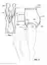 Fig. 02 - Apparatus for sexual activity usage