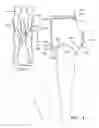 Fig. 08 - Apparatus for sexual activity usage