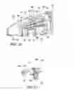 Fig. 06 - Ocular implant insertion apparatus and methods