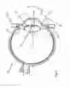 Fig. 02 - Device for producing cuts or perforations on an eye