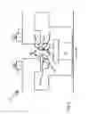 Fig. 04 - Device for producing cuts or perforations on an eye