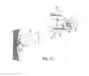 Fig. 13 - Delivery System and Method of Use for the Eye