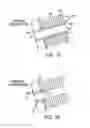 Fig. 16 - Delivery System and Method of Use for the Eye