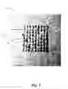 Fig. 04 - Thermal reflective layer for a wound care dressing