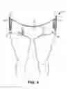 Fig. 05 - UNDERGARMENT AND RELATED METHODS OF SECURING AND DISPOSAL OF SAID UNDERGARMENT