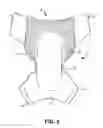 Fig. 06 - UNDERGARMENT AND RELATED METHODS OF SECURING AND DISPOSAL OF SAID UNDERGARMENT