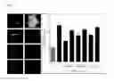 Fig. 07 - COSMETIC COMPOSITION COMPRISING WHITE ROSE FLOWER EXTRACT FOR SKIN WHITENING AND IMPROVING SKIN WRINKLE