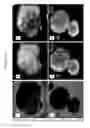 Fig. 20 - NANOPARTICLES FOR TARGETED GENE THERAPY AND METHODS OF USE THEREOF