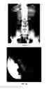 Fig. 02 - Enterically coated cysteamine, cystamine and derivatives thereof