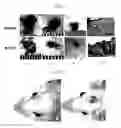 Fig. 02 - COMPOSITIONS AND METHODS FOR TREATING ALOPECIA