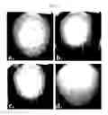 Fig. 04 - COMPOSITIONS AND METHODS FOR TREATING ALOPECIA