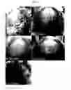 Fig. 05 - COMPOSITIONS AND METHODS FOR TREATING ALOPECIA