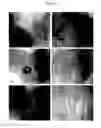 Fig. 08 - COMPOSITIONS AND METHODS FOR TREATING ALOPECIA