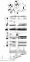 Fig. 13 - Method for treating a gastrointestinal disorder in a mammal using bacteroides thetaiotaomicron and compositions thereof