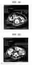 Fig. 02 - METHODS AND COMPOSITIONS FOR TREATING VIRAL OR VIRALLY-INDUCED CONDITIONS