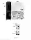 Fig. 02 - Methods for treating T-cell acute lymphoblastic leukemia