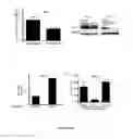 Fig. 07 - Methods for treating T-cell acute lymphoblastic leukemia