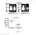 Fig. 15 - Methods for treating T-cell acute lymphoblastic leukemia
