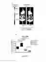 Fig. 21 - Methods for treating T-cell acute lymphoblastic leukemia