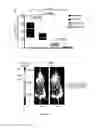 Fig. 23 - Methods for treating T-cell acute lymphoblastic leukemia