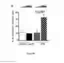 Fig. 31 - Methods for treating T-cell acute lymphoblastic leukemia