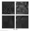 Fig. 28 - Treating ocular neovascularization