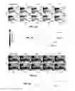 Fig. 05 - Methods of Treating Neurological Diseases