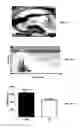 Fig. 06 - Methods of Treating Neurological Diseases