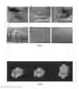 Fig. 02 - COMPOSITION FOR LOCAL AND CONTROLLED RELEASE OF DRUGS AND METHODS THEREOF