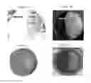 Fig. 05 - SYSTEM AND METHOD FOR PRODUCTION OF SHELF STABLE PROBIOTICS FOR ANIMAL NUTRITION ENHANCEMENT
