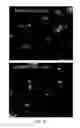 Fig. 29 - TREATMENT OF COMPLEMENT-ASSOCIATED DISORDERS