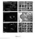 Fig. 30 - TREATMENT OF COMPLEMENT-ASSOCIATED DISORDERS
