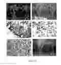 Fig. 33 - TREATMENT OF COMPLEMENT-ASSOCIATED DISORDERS
