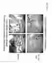 Fig. 46 - TREATMENT OF COMPLEMENT-ASSOCIATED DISORDERS