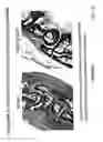 Fig. 48 - TREATMENT OF COMPLEMENT-ASSOCIATED DISORDERS